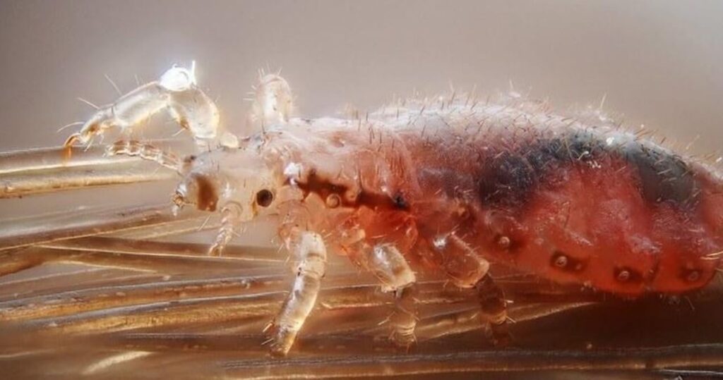 How Long Can Lice Live on a Car Seat
